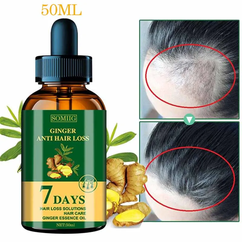 Масло эфирное Ginger Hair Growth Essential Oil для быстрого роста волос и профилактики облысения у мужчин и женщин.