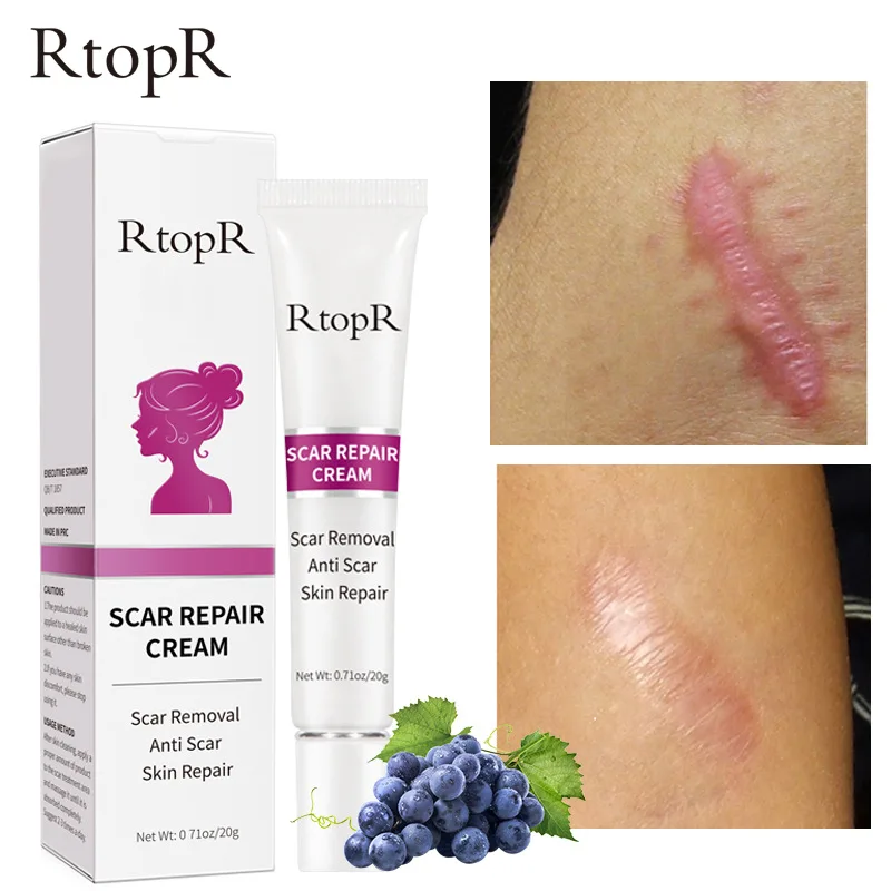 Scar Removal Fade Scars Scar Removing Cream Skin Lightening Cream  Skin Care Products  C Section Scar