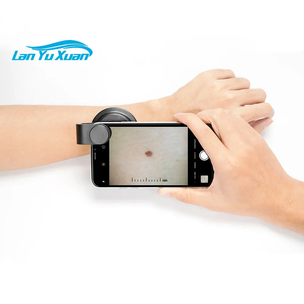 

Medical Microscope USB Rechargeable LED Illumination Dermatoscope
