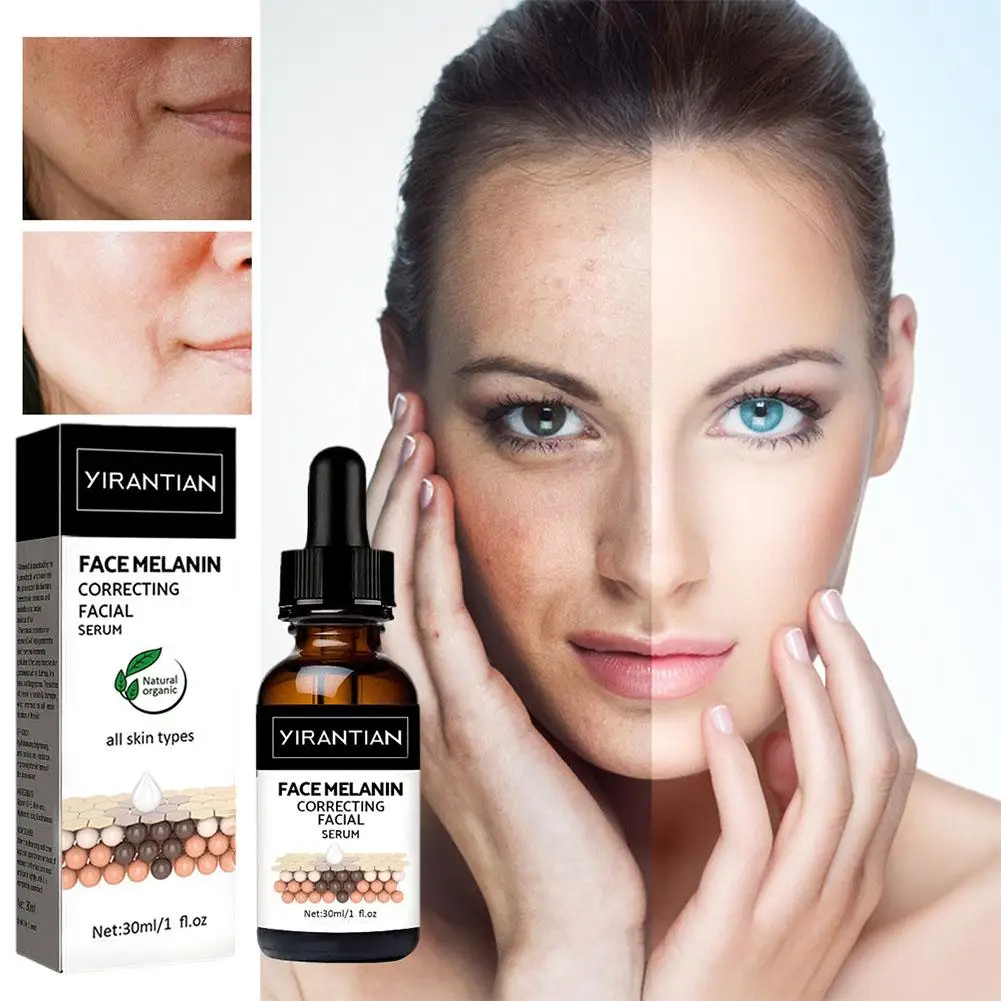 

Effective Whitening Freckle Serum Removal Melasma Acne Corrector Skin Fade Dark Moisturizing Brighten Care Spots Pigment H1R9