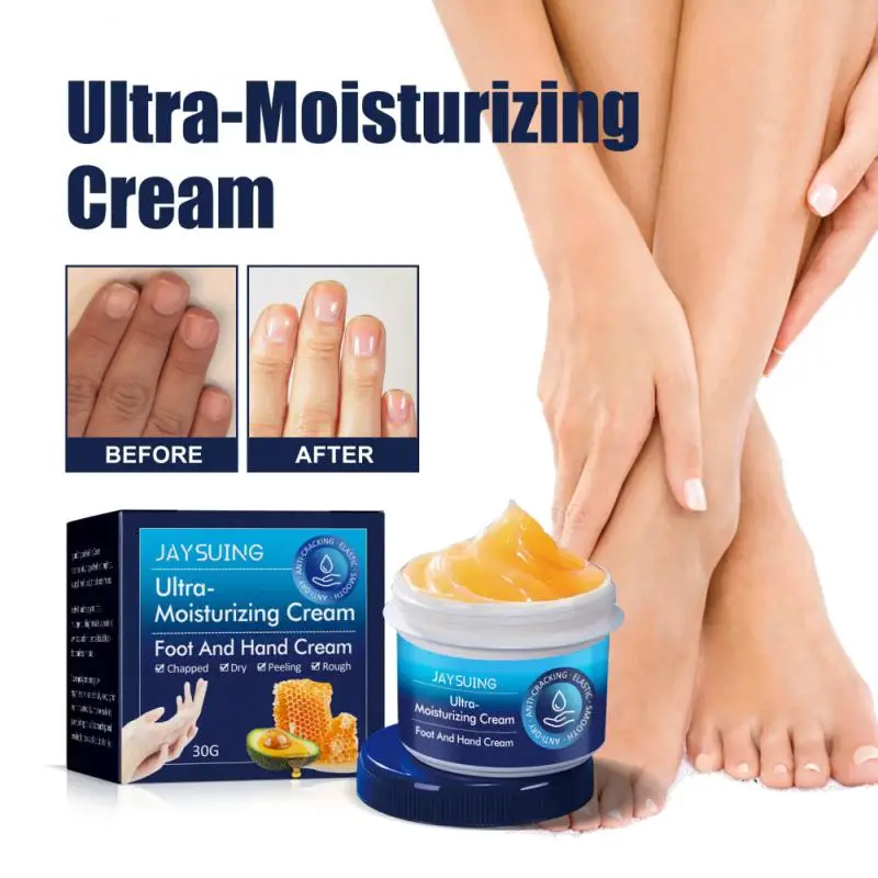 Anti-crack Repair Hand Lotions Improve Cracked And Rough Dea