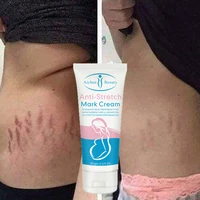 creme corporal remove pregnancy scars acne cream stretch mark treatment maternity repair anti aging winkle firming body cream