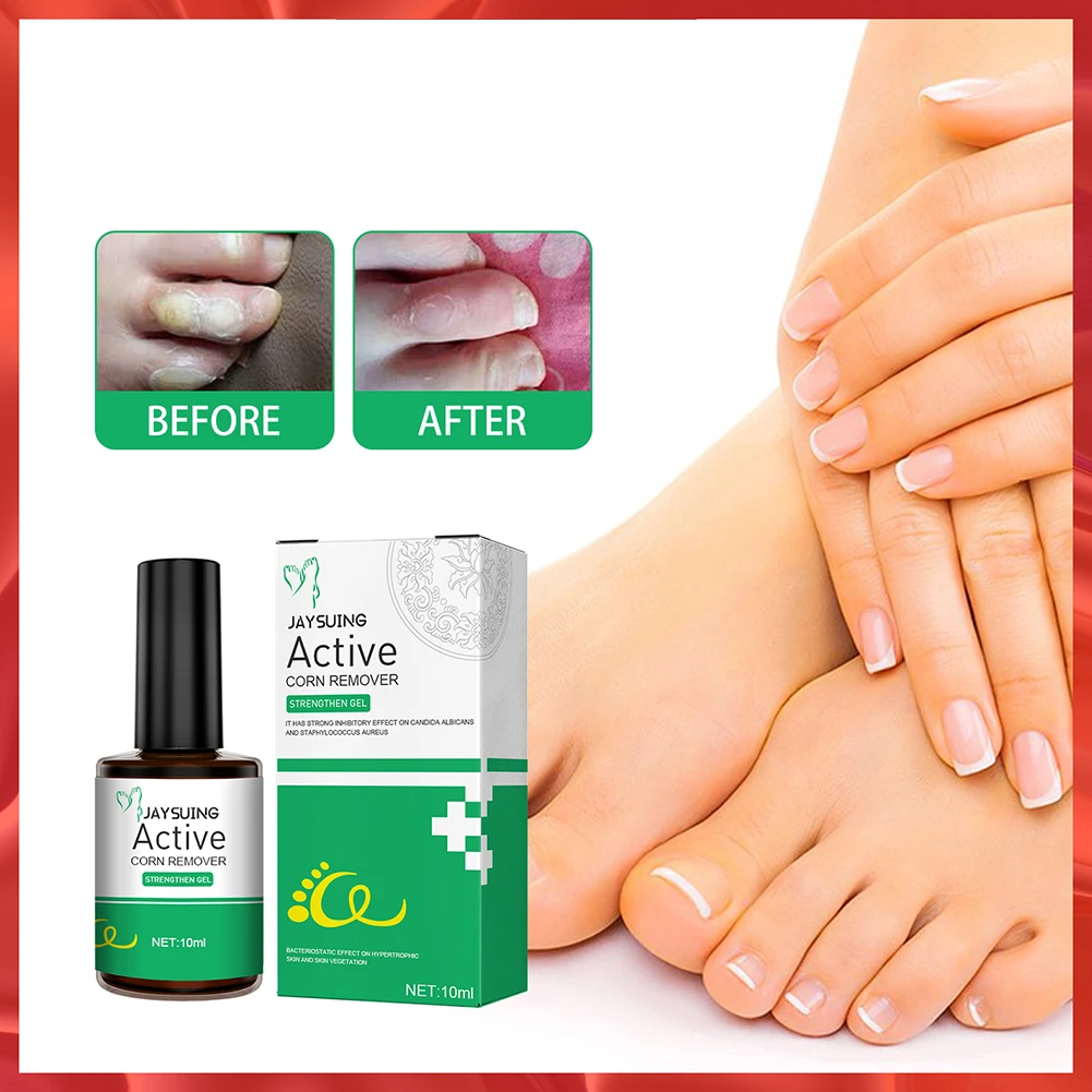 

Blemish Corns Wart Removal Gel Painless Body Wart Treatment Cream Foot Care Massage Instrument Foot Spa Foot Massage