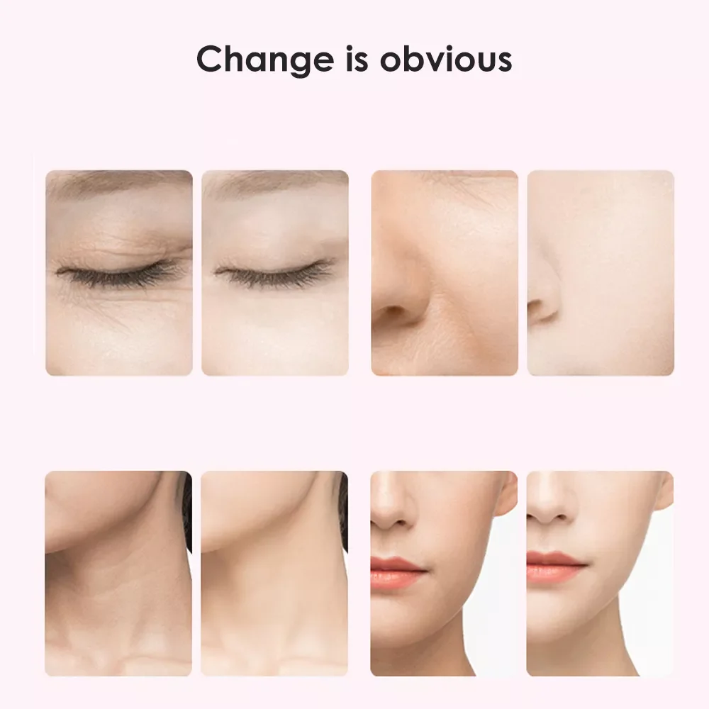 

Face Skin Care Anti Wrinkles Forehead Skin Tighten Beauty Product