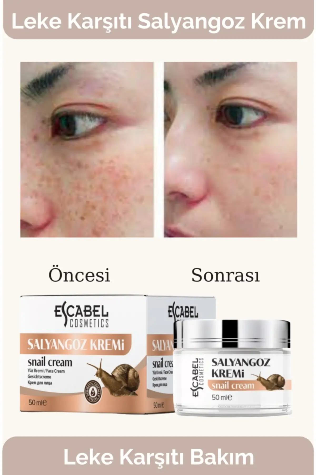 Crema corporal y facial 100 Original, crema antimanchas para reparar grietas con Caracol que contiene granos y acn&eacute;, 50ml-0