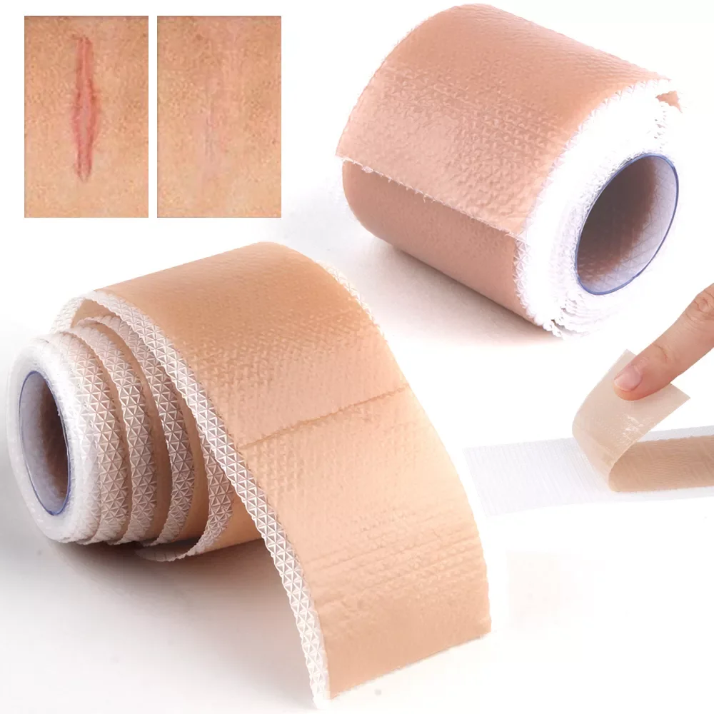 

Silicone Scar Removal Sheet Acne Trauma Burn Scar Skin Repair Keloid Silicone Patch Efficient Surgery Caesarean Section Gel Scar