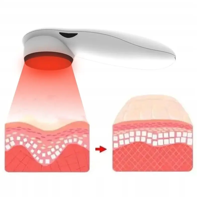 Холодный лазер LLLT для нейропатии тканей шрамов хиропрактика домашнего