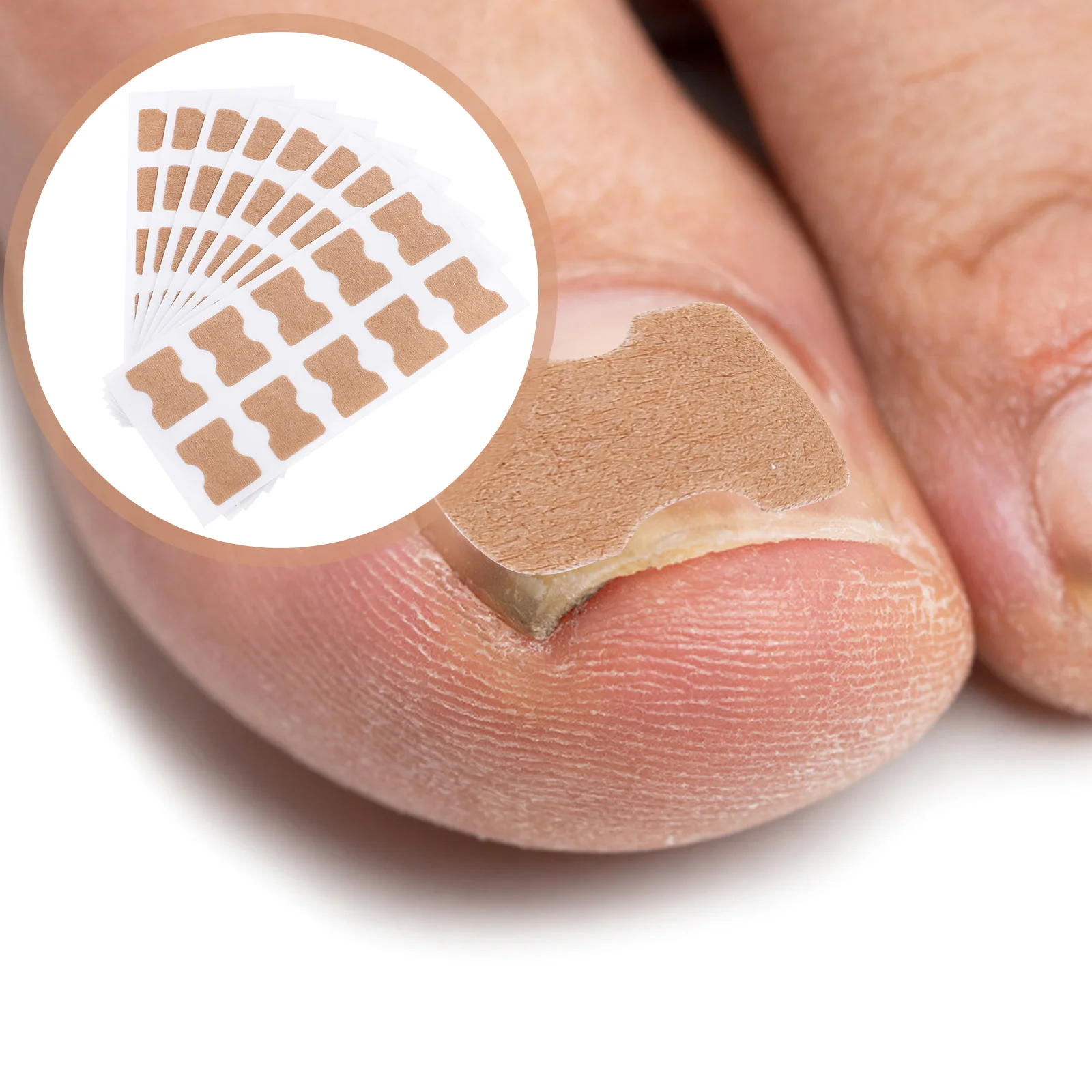 

1 Set Effective Practical Convenient Self-adhesive Portable Toenail Orthopaedic Stickers Foot Nail Care Tools