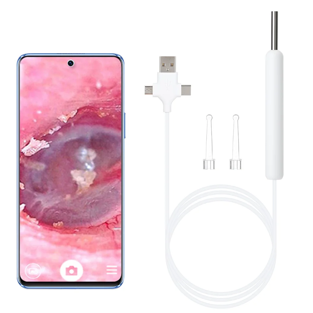 Визуальный HD-эндоскоп для ушей 3 в 1, USB-эндоскоп для чистки, инструмент для камеры наблюдения, удаление ушного воска для телефона Android, ПК (art.: 3920c192975d0) - 3920c192975d0
