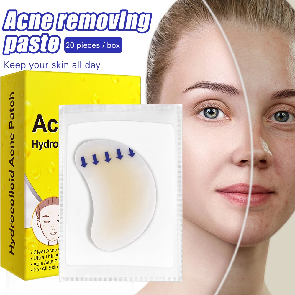 

20PCS acne remover patch Crescent Shaped Hydrocolloid Acne Pimple Patch for Covering Zit Reduce Swelling Suck Acne