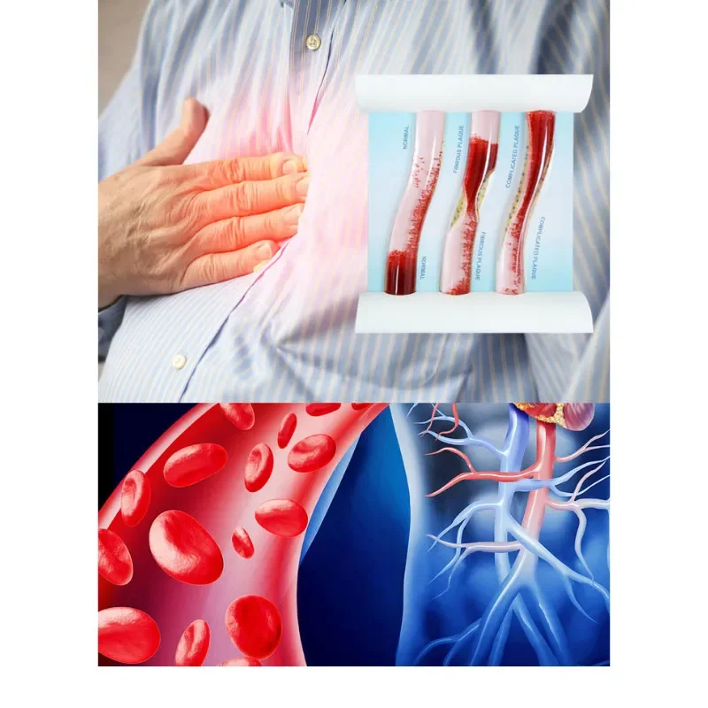 Трехсудочная модель сосудистый: здоровая артерия и симуляция блокировки в