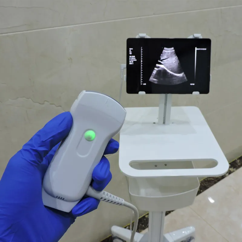 

2021 New 128 elements 3 in 1 ultrasound wifi&USB color doppler medical probe C10RL from Beijing konted