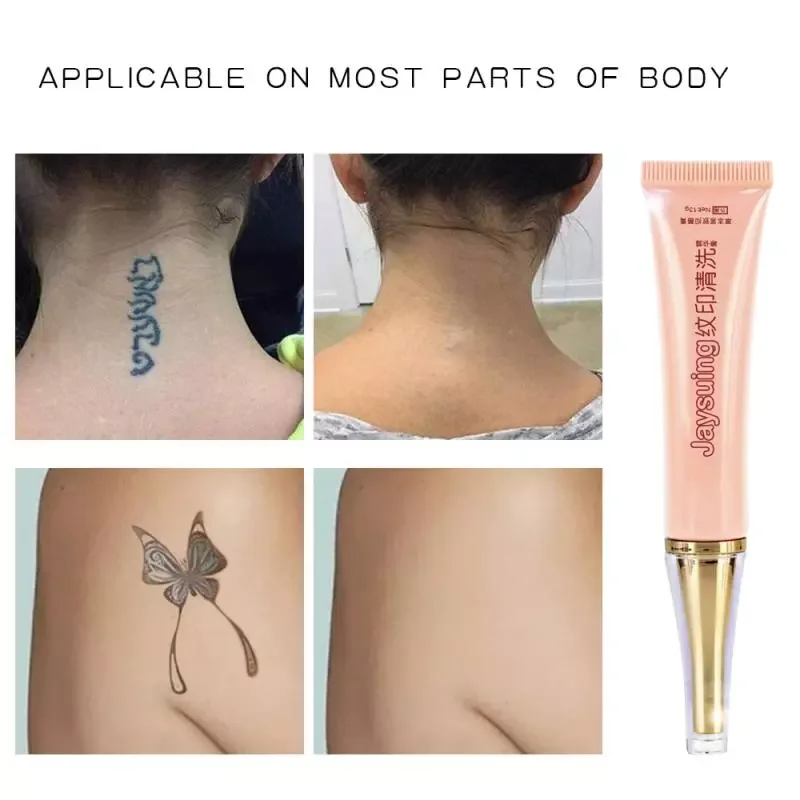 

NEW2023 2020 No Need For Pain Removal Maximum Strength NEW Permanent Tattoo Removal Cream