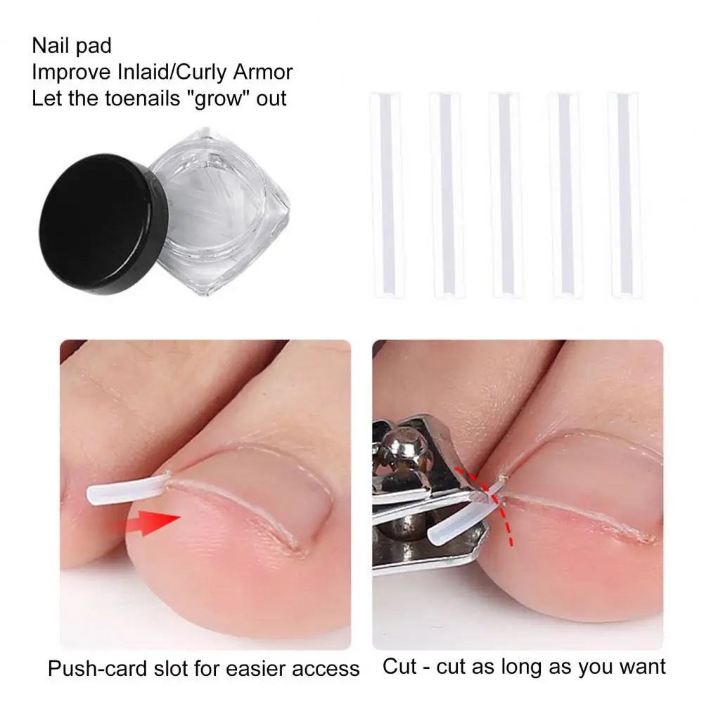 

1 Set Universal Nail Corrector Pad Professional Toenail Care Pedicure Tool Toenail Correction Patch Toenail Corrector Kit