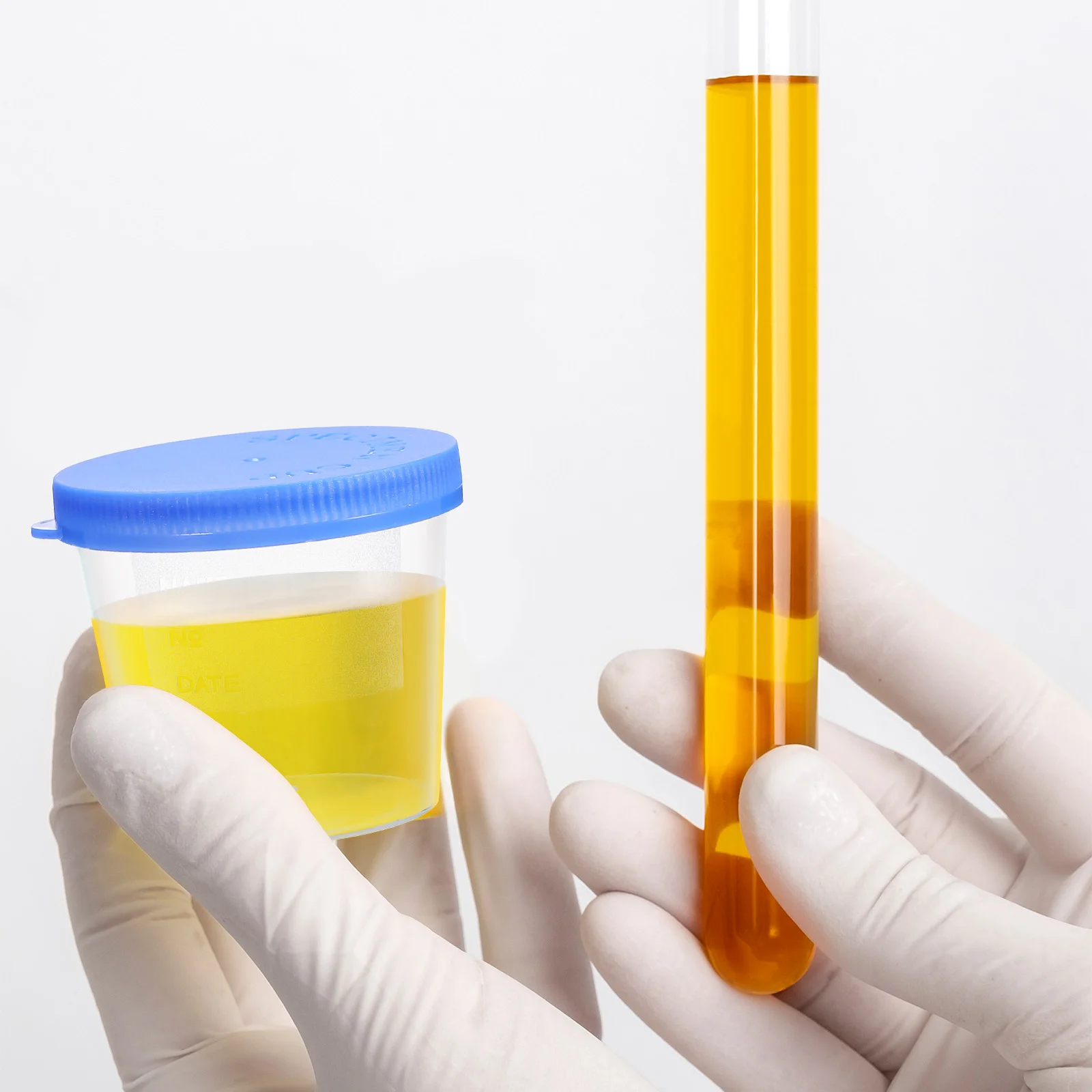 30 шт. контейнер для образцов мочи одноразовые чашки мокроты с крышкой