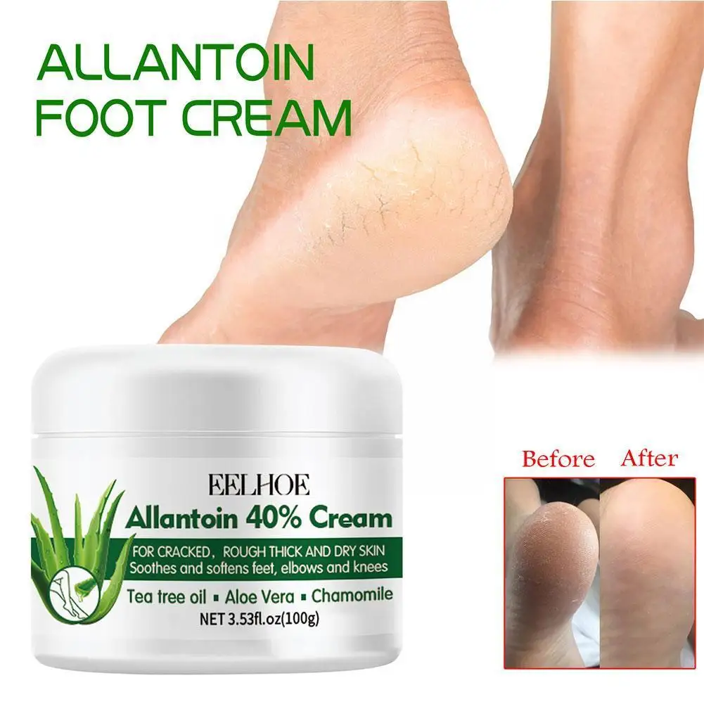 

Urea 40% Cream for Dry Cracked Feet Heels Hands Body Repairing Treatment Deeply Moisturizing Callus Dead Skin Remove Foot C G8K2