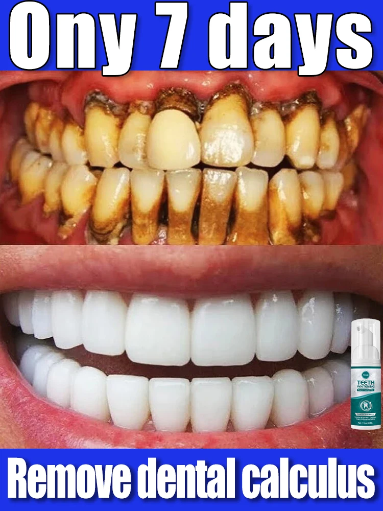 Резолирующий много Los Балка стоматологов