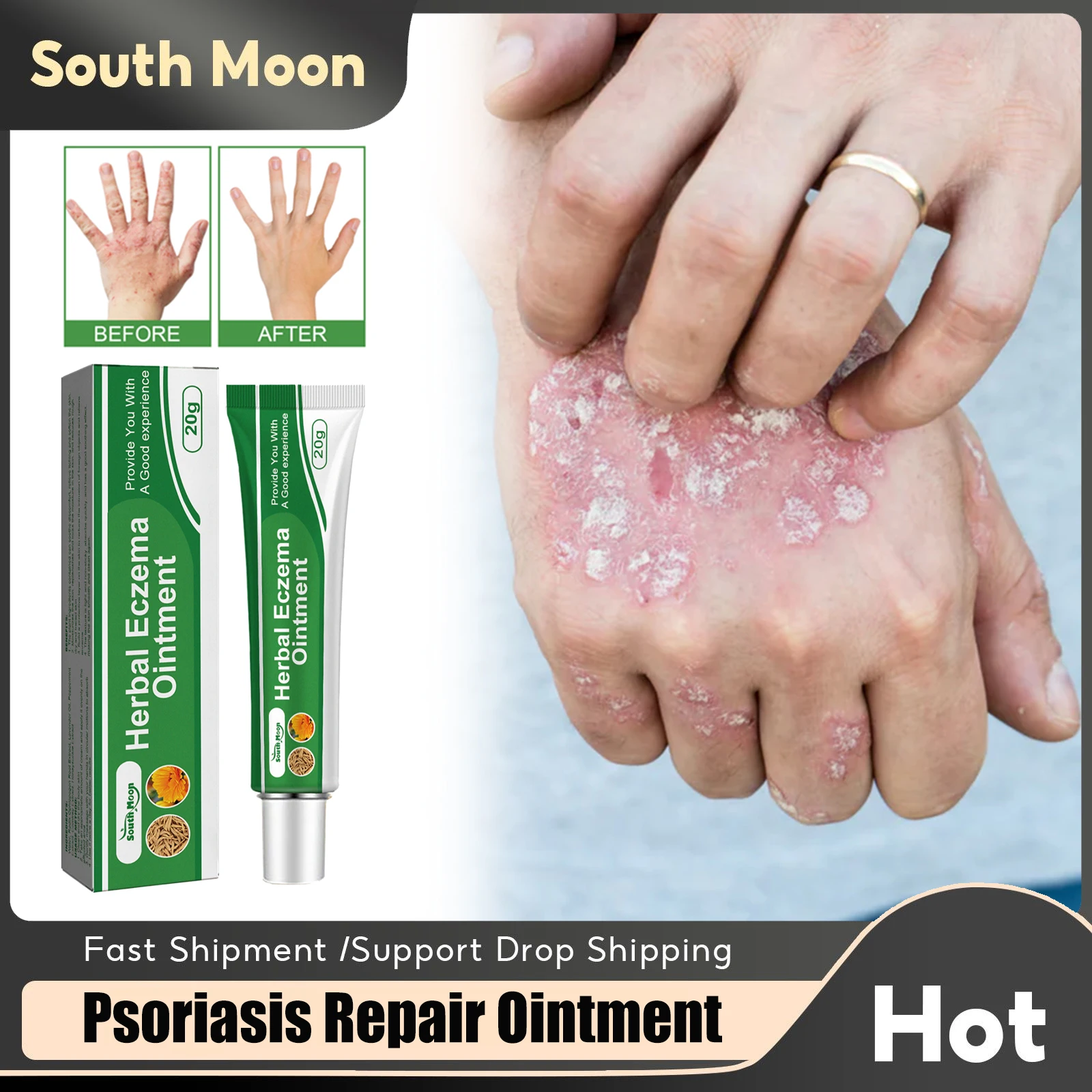 

Herbal Eczema Ointment Psoriasis Dermatitis Treatment Improve Redness Relieve Body Itching Anti Inflammatory Skin Repair Cream