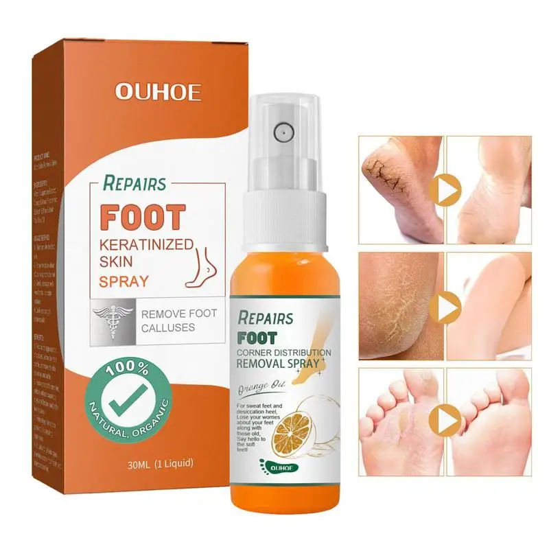 

Foot Peeling Spray 1 Oz Natural Orange Essence Pedicure Hands Dead Skin Exfoliator Mask Whiten Smooth Foot Care Tool Cosmetics