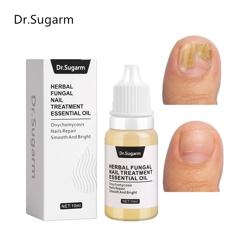 Средство для лечения Ногтей от грибков Dr.Sugarm, средство для ухода за ногами, грибок против инфекции, паронихия, онихомикоз