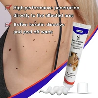 20ml 1pcs removal warts cream skin tags removing against moles remover anti verruca remedy genital wart treatment papillomas