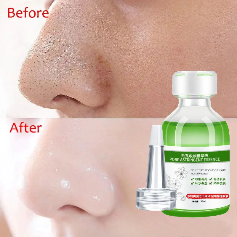 

Lactobionic Acid Pore Shrink Face Serum Moisturizing Nourish Oil-Control Firming Smooth Pore Repair Essence Anti Aging Skin Care