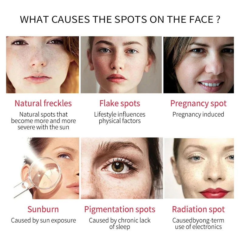 Рисунок 6 - Dimollaure крем для отбеливания веснушек