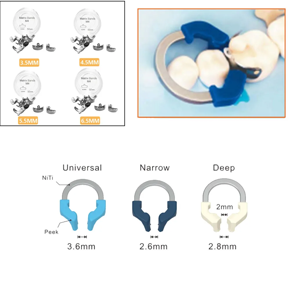 1 шт. стоматологические матричные ленты NITI металлические матрицы зажимное кольцо