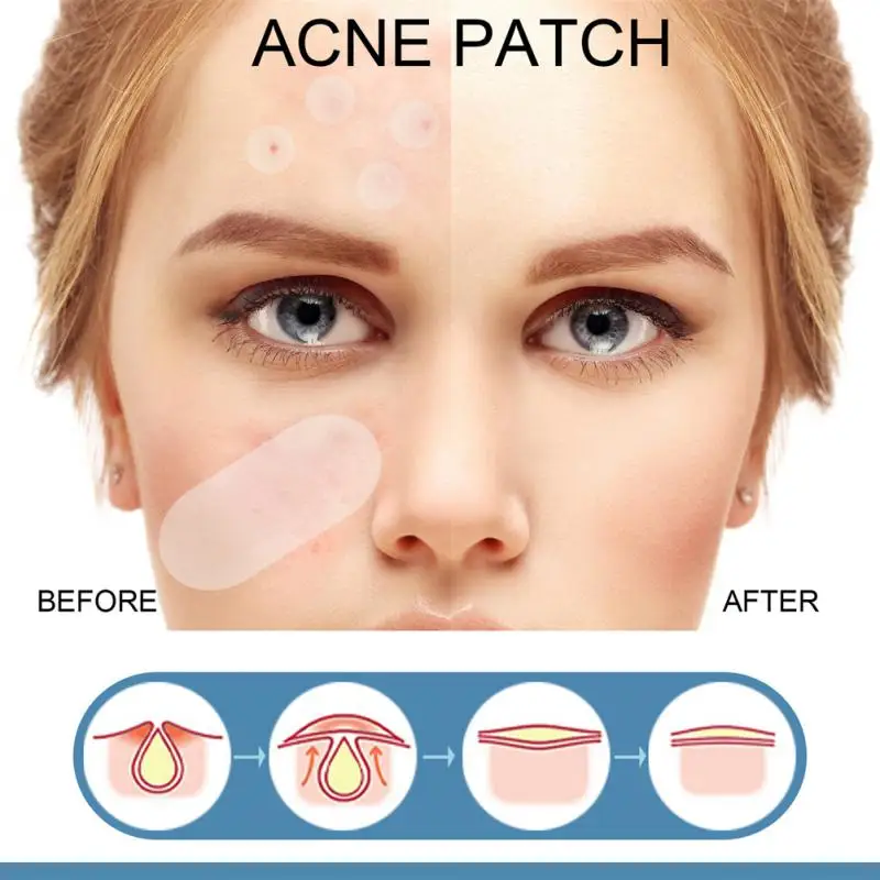 

Invisible Acne Pimple Sticker Hydrocolloid Acne Removal Patch Waterproof Black Head Remover Facial Skin Care