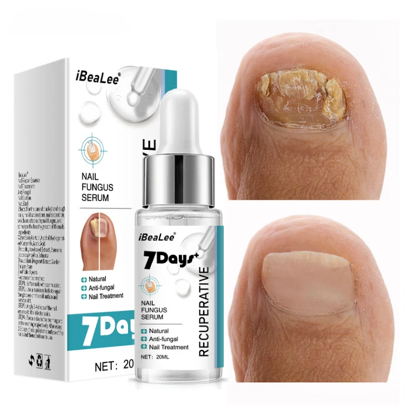 

7DAYS Repair Nail Fungus Treatments Essence Foot Care Serum Toe Nails Fungal Removal Gel Anti-Infection Onychomycosis