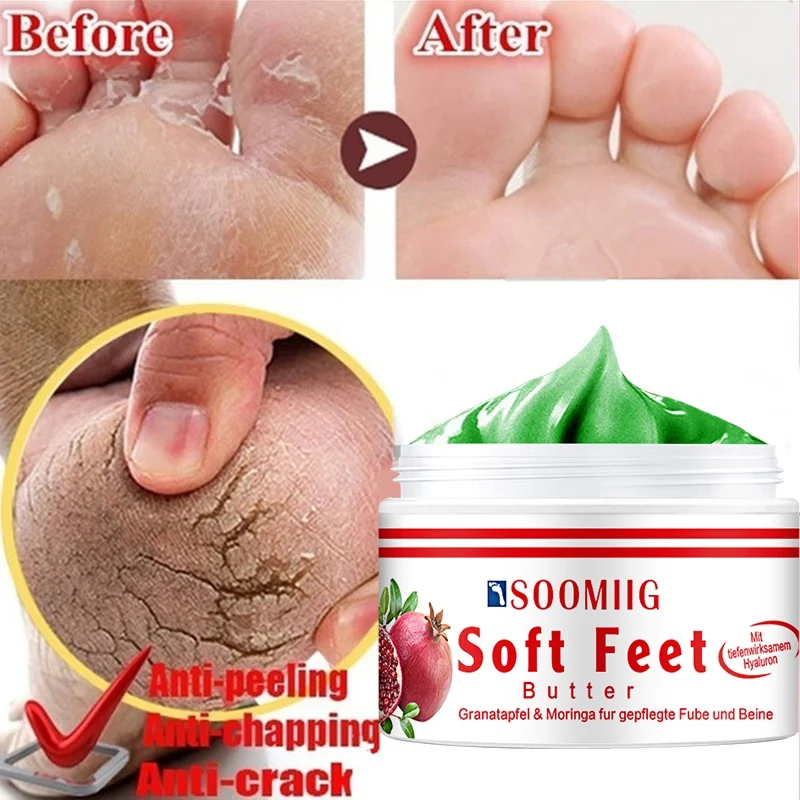 Рисунок 2 - Крем для ног с защитой от сухости и трещин