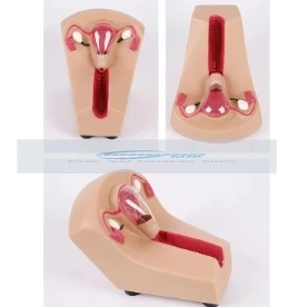 Модель внутриуточечного противозачаточного устройства для женщин обучающий