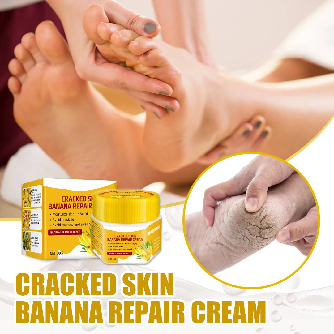 

1 Pc 30g Banana Cracked Skin Repair Cream Feet Heel Moisturizing Dead Skin Removal Hand Feet Care Ointment Treatment Health