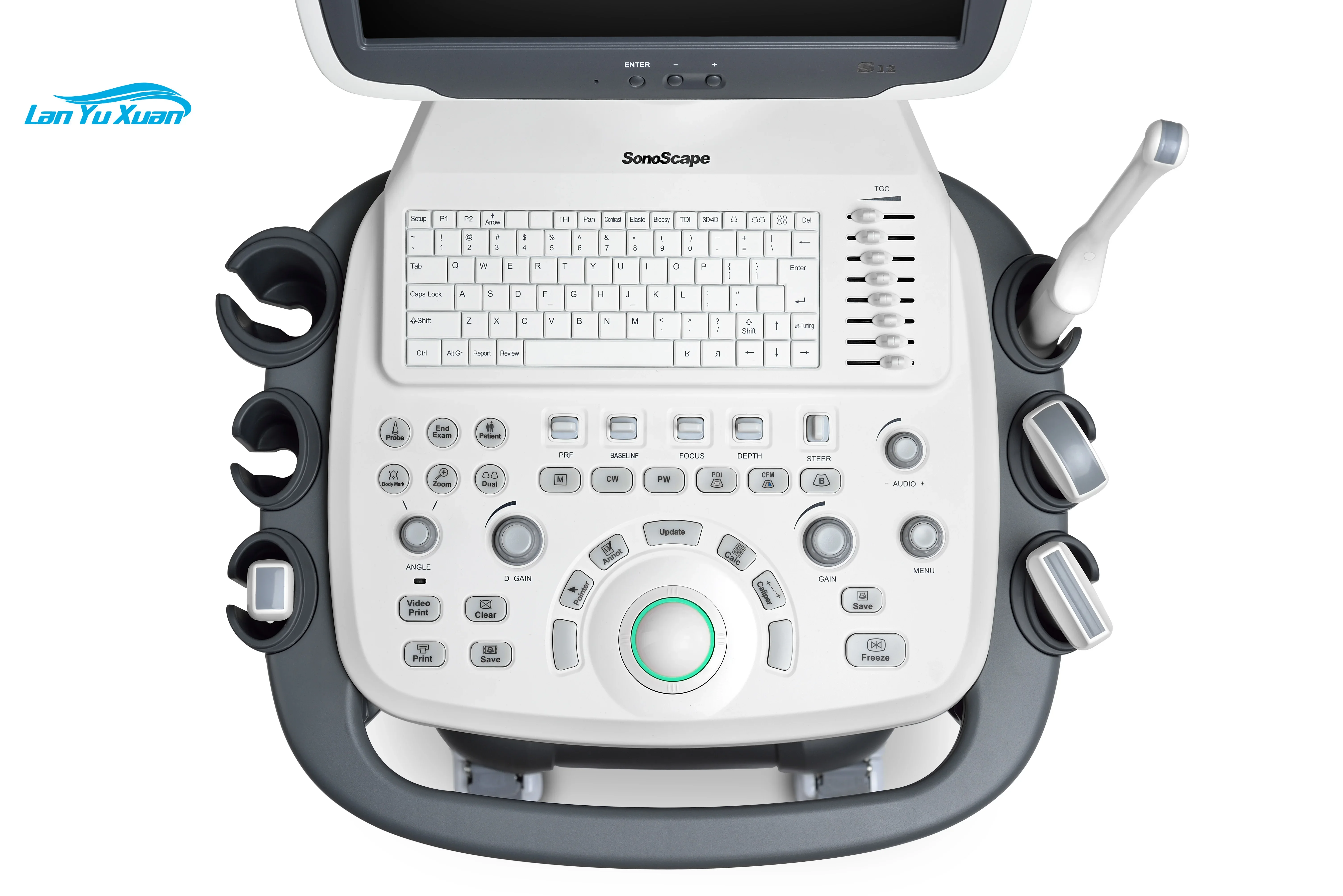 Рисунок 4 - Мобильный ультразвуковой аппарат