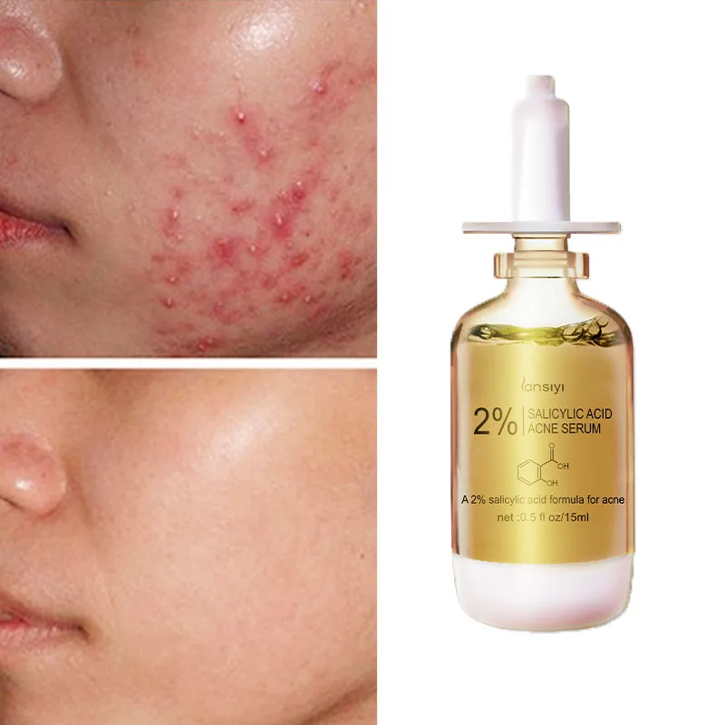 

Salicylic Acid Acne Removal Face Serum Effective Acne Treatment Repair Spots Scar Moisturizing Oil Control Shrink Pore Skin Care