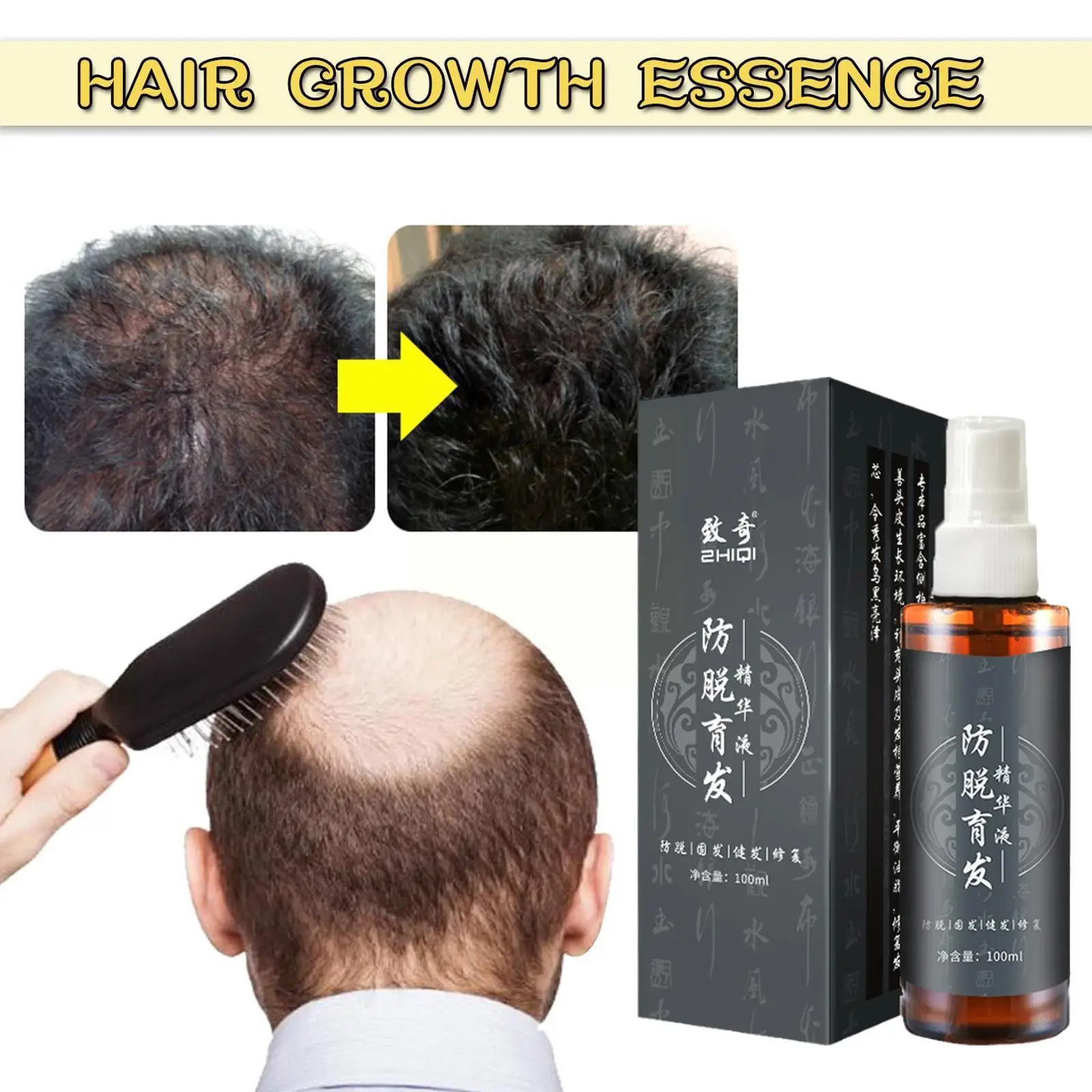 

Hair Growth Serum Fast Hair Growth Liquid Treatment Scalp Hair Health Hair Hair Beauty Natural Care Anti Loss Follicle I4P8