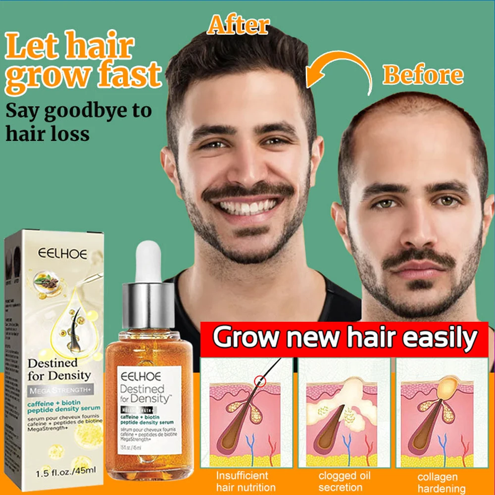 Fast Hair Growth Essential Oil Bald Hair Follicle Treatment Seborrheic Alopecia Hairline Upward Repair Serum Products Men Women