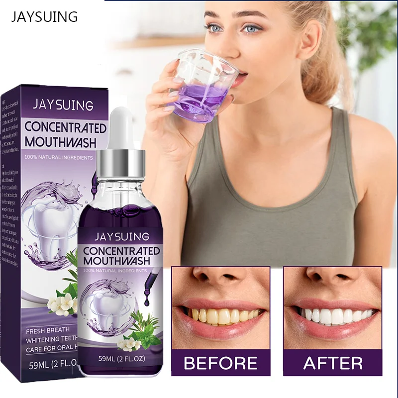 

Teeth Whitening Mouthwash Long-lasting Breath Fresheners Remove Tartar Care For Gums Concentrated Mouthwash Oral Hygiene Cleans