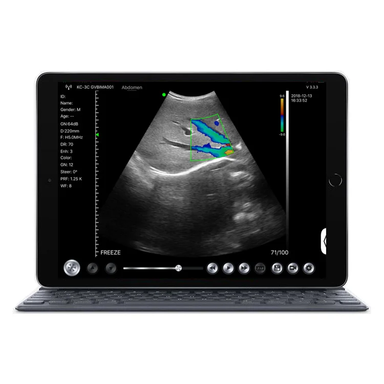 Рисунок 4 - Беспроводная портативная фотовспышка