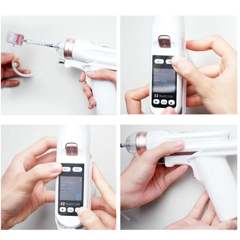 Рисунок 4 - 5/9 игла фильтр отрицательного