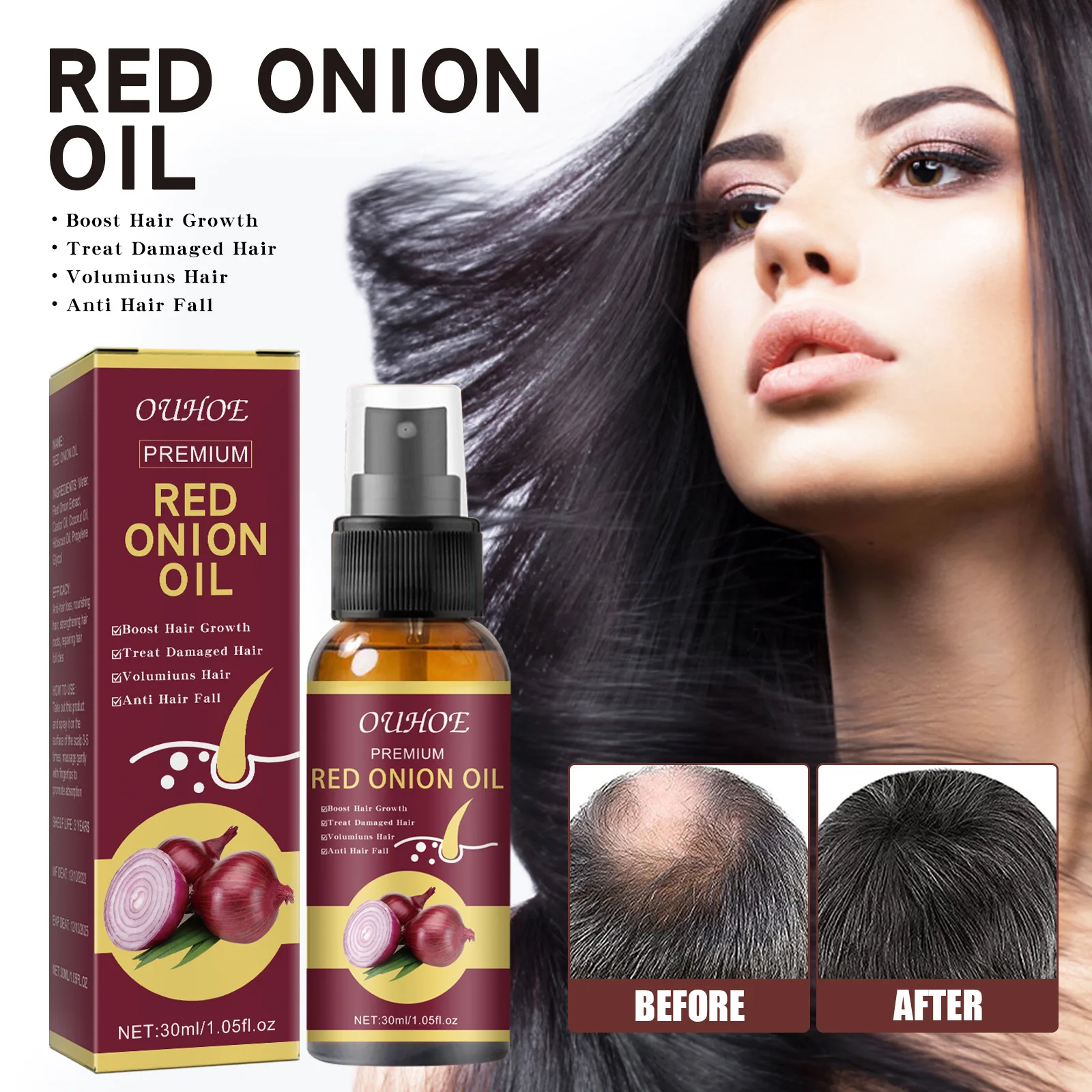 ONION OIL for Extreme Hair Growth Thick Hair, Breakage, Scal