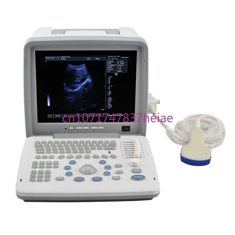 

Veterinary 12 Inch LED Screen Animal Pet Portable Ultrasound Scanner Machine