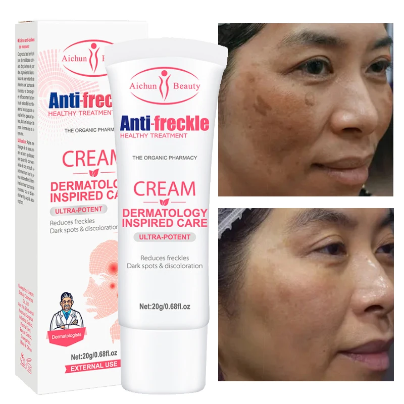 

Nicotinamide Freckle Face Cream Lifting Firming Anti-Aging Fade Fine Lines Tighten Products Smooth Skin Nourish Beauty Care 20g