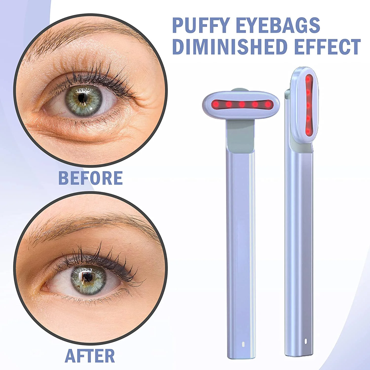 Лидер продаж массажер для глаз против морщин беспроводное зарядное устройство