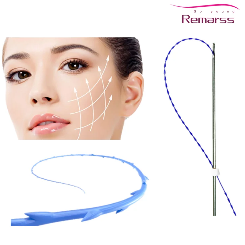 Огромная Цена со скидкой китайский поставщик лифтинг для носа ПДО-резьба форма