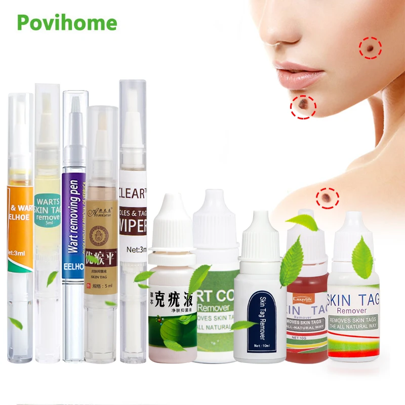 

12 типов, бриллиантовый крем для удаления мозолей