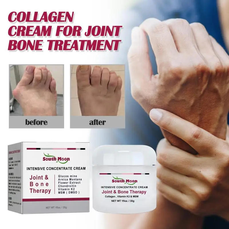

30g Arthritises Pain Relief Cream Knee Joint Pain Relief Ointment Extra Strength Topical Pain Relief Cream Perfectex Joint Bone