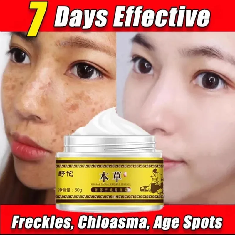 

Effective Remove Melasma Freckle Cream Whitening Freckle Cream Inhibit Melanin Hydrating Brighte Remove Pigment Facial Skin Care