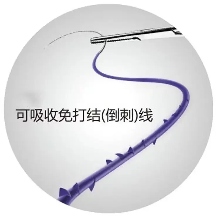 Medical surgery absorbable Barbed thread sutures PDO fish bone Disposable Suture