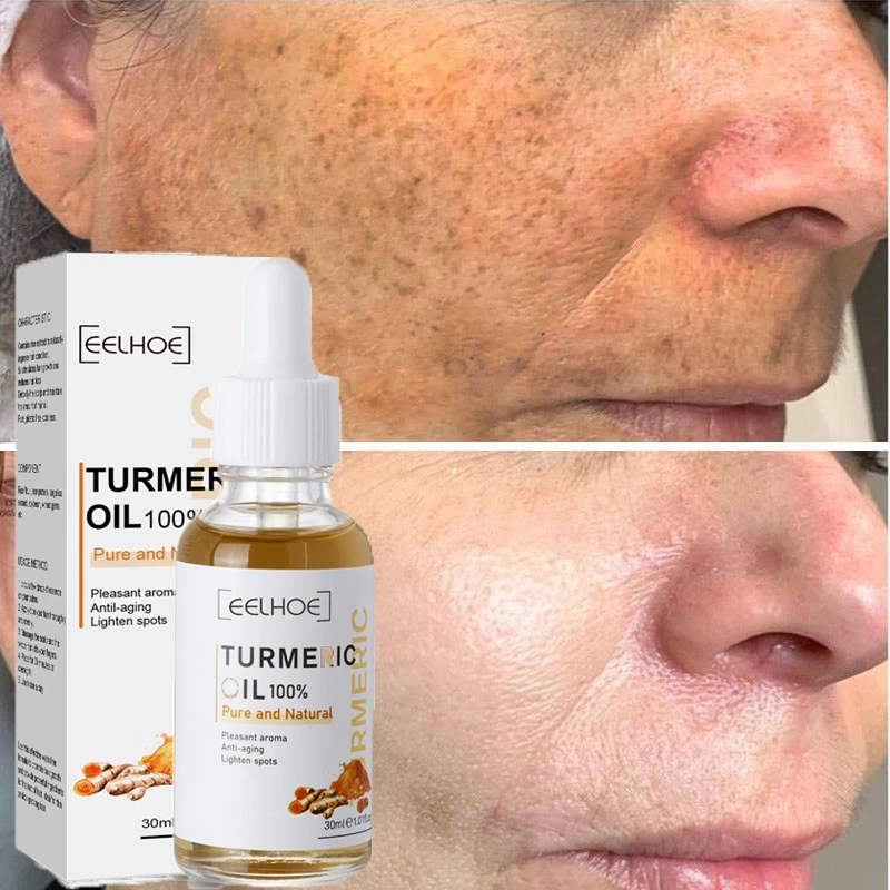 30ml Turmeric Dark Spot Removal Serum Oil Whitening Anti Wrinkle Remove Fine Line Melanin Pigment Spot Essence Moisturizing Care